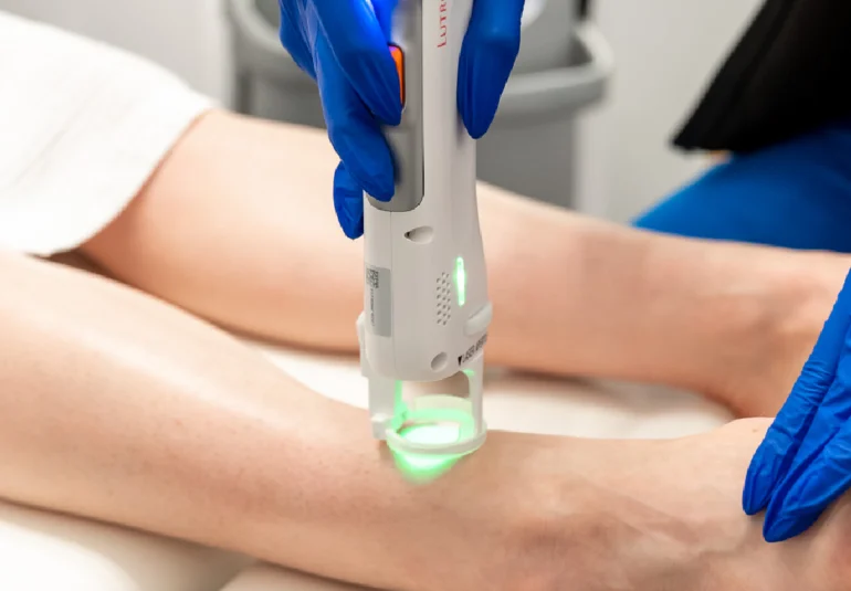 relive health hendersonville medspa employee administering Laser Hair Removal treatment to patient 1600x733 1