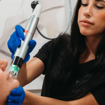 Handheld Microneedling