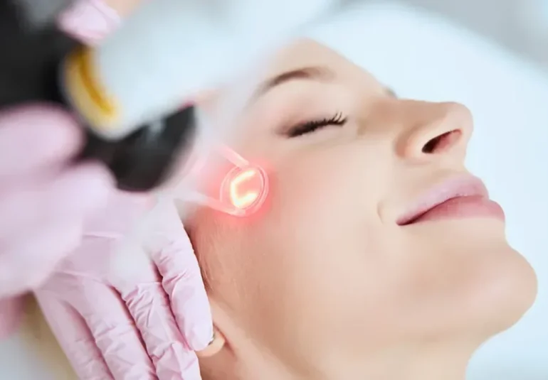 Laser Skin Resurfacing