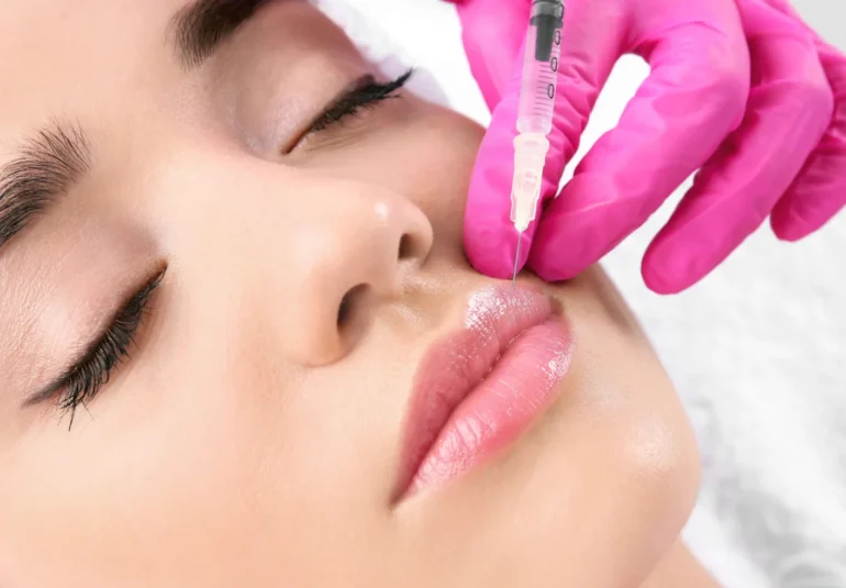 Dermal Fillers